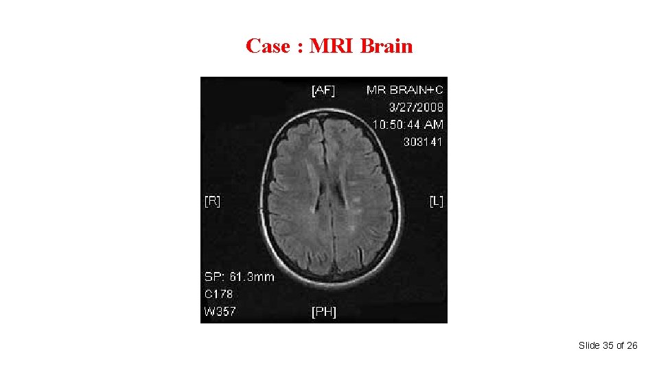 Case : MRI Brain Slide 35 of 26 