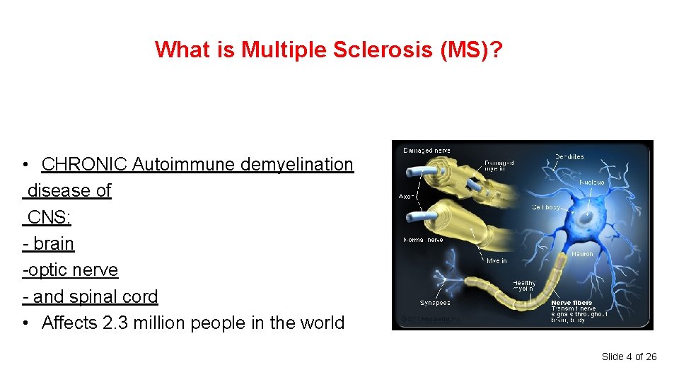 What is Multiple Sclerosis (MS)? • CHRONIC Autoimmune demyelination disease of CNS: - brain