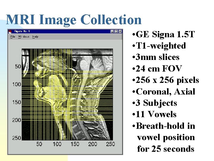 MRI Image Collection • GE Signa 1. 5 T • T 1 -weighted •