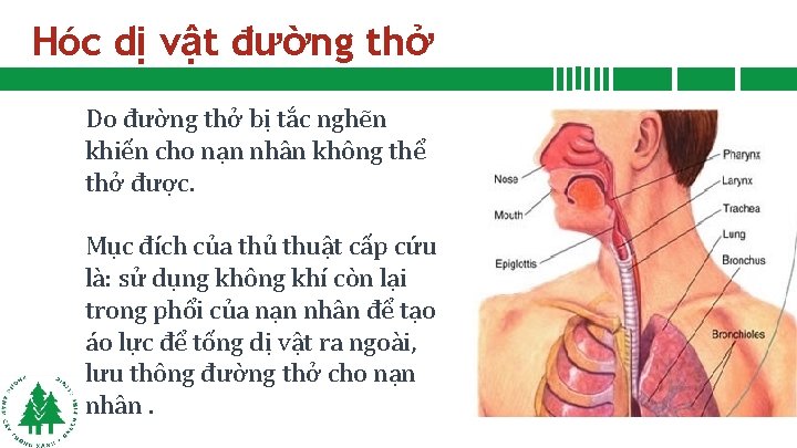 Hóc dị vật đường thở Do đường thở bị tắc nghẽn khiến cho nạn