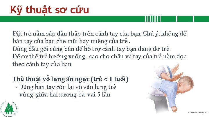 Kỹ thuật sơ cứu Đặt trẻ nằm sấp đầu thấp trên cánh tay của