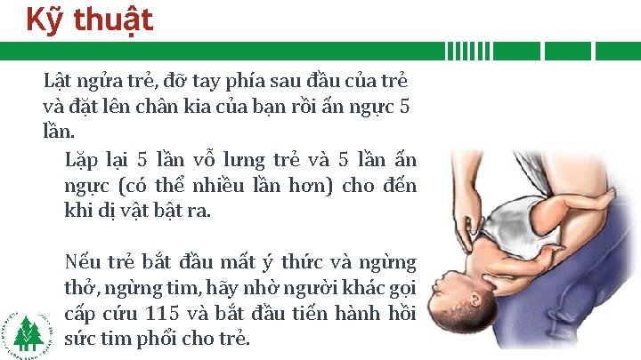 Kỹ thuật Lật ngửa trẻ, đỡ tay phía sau đầu của trẻ và đặt