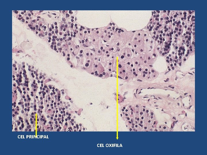 CEL PRINCIPAL CEL OXIFILA CEL PRINCIPAL CEL OXIFILA