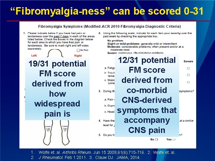 “Fibromyalgia-ness” can be scored 0 -31 19/31 potential FM score derived from how widespread