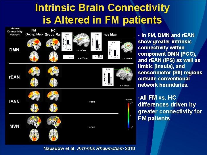 Intrinsic Brain Connectivity is Altered in FM patients • In FM, DMN and r.