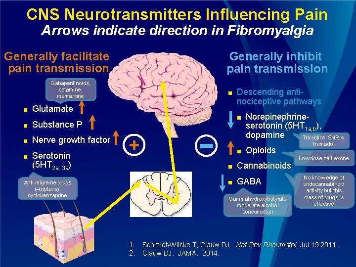 CNS Neurotransmitters Influencing Pain Arrows indicate direction in Fibromyalgia Generally facilitate pain transmission Generally