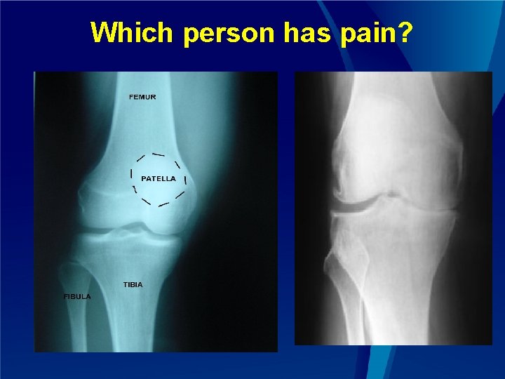 Which person has pain? 