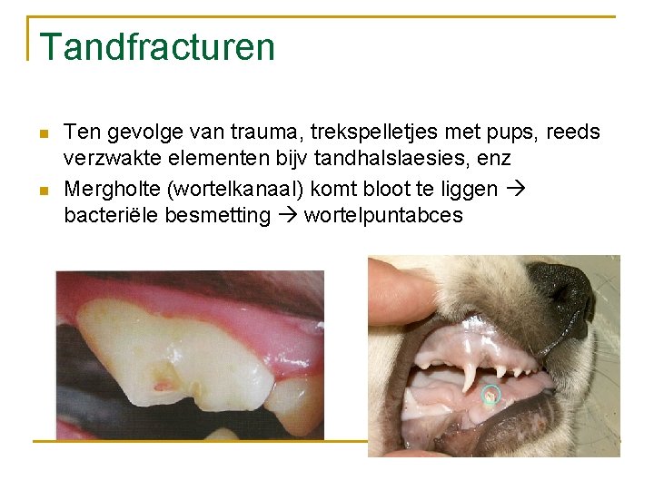 Tandfracturen n n Ten gevolge van trauma, trekspelletjes met pups, reeds verzwakte elementen bijv