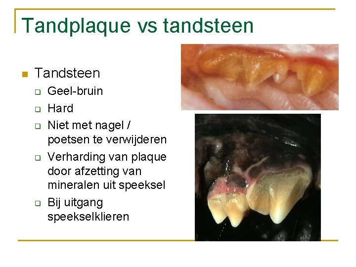 Tandplaque vs tandsteen n Tandsteen q q q Geel-bruin Hard Niet met nagel /