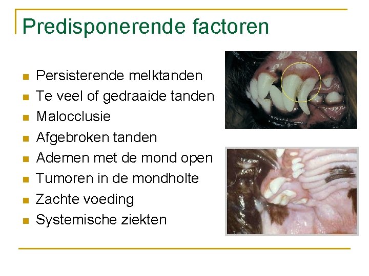 Predisponerende factoren n n n n Persisterende melktanden Te veel of gedraaide tanden Malocclusie