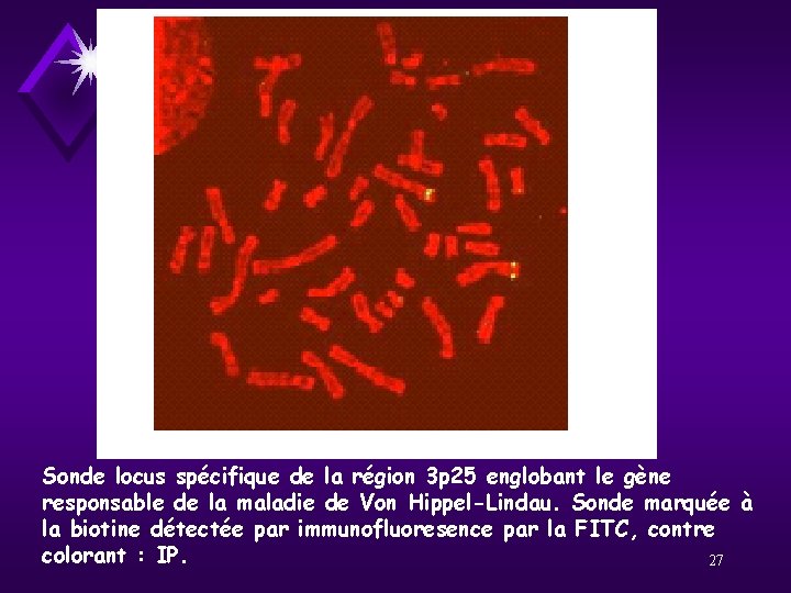 Sonde locus spécifique de la région 3 p 25 englobant le gène responsable de