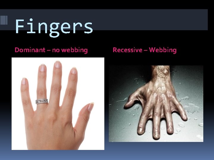 Fingers Dominant – no webbing Recessive – Webbing 