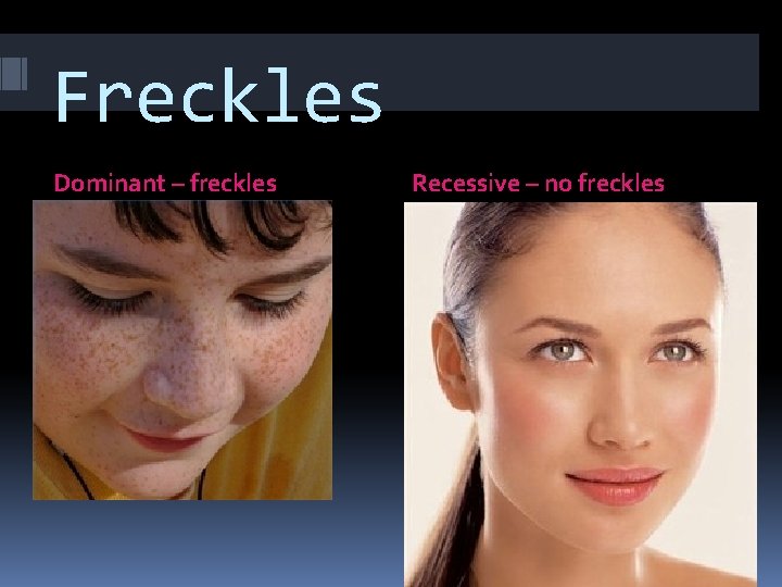 Freckles Dominant – freckles Recessive – no freckles 