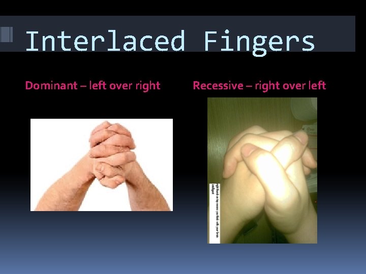 Interlaced Fingers Dominant – left over right Recessive – right over left 