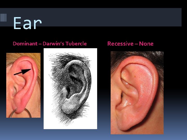 Ear Dominant – Darwin’s Tubercle Recessive – None 