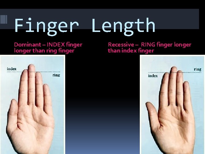 Finger Length Dominant – INDEX finger longer than ring finger Recessive – RING finger