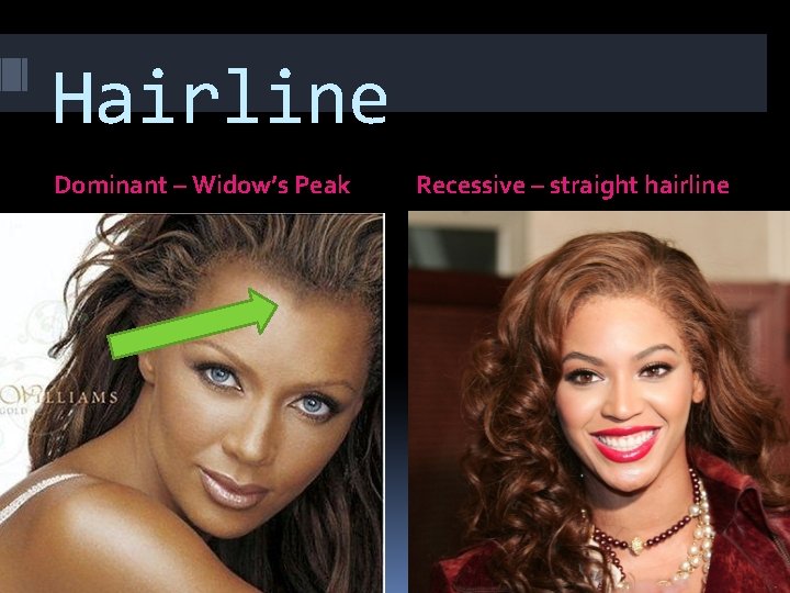 Hairline Dominant – Widow’s Peak Recessive – straight hairline 