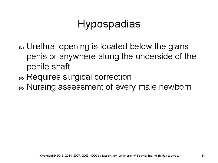 Hypospadias Urethral opening is located below the glans penis or anywhere along the underside
