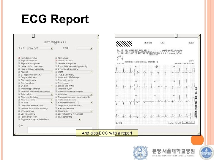 ECG Report And also ECG with a report 