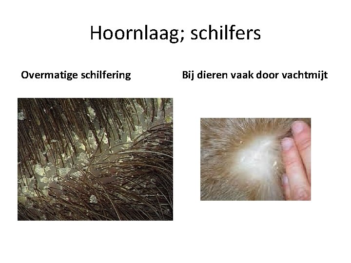 Hoornlaag; schilfers Overmatige schilfering Bij dieren vaak door vachtmijt 