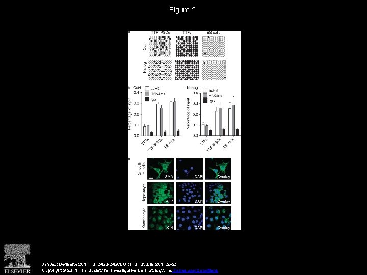Generation of Melanocytes from Induced Pluripotent Stem Cells