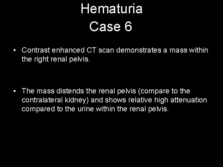 Hematuria Case 6 • Contrast enhanced CT scan demonstrates a mass within the right