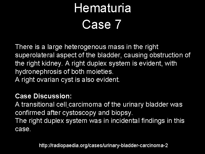 Hematuria Case 7 There is a large heterogenous mass in the right superolateral aspect