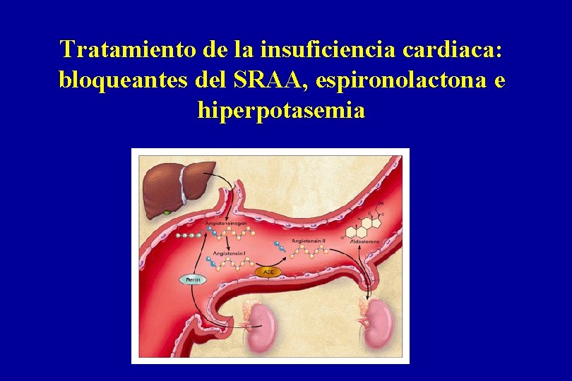 Tratamiento de la insuficiencia cardiaca: bloqueantes del SRAA, espironolactona e hiperpotasemia 