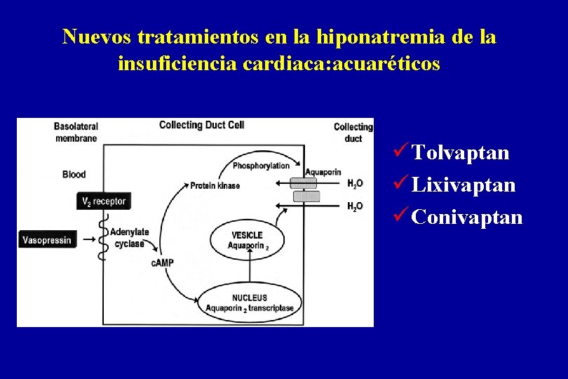Nuevos tratamientos en la hiponatremia de la insuficiencia cardiaca: acuaréticos ü Tolvaptan ü Lixivaptan