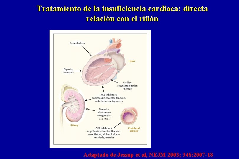 Tratamiento de la insuficiencia cardiaca: directa relación con el riñón Adaptado de Jessup et