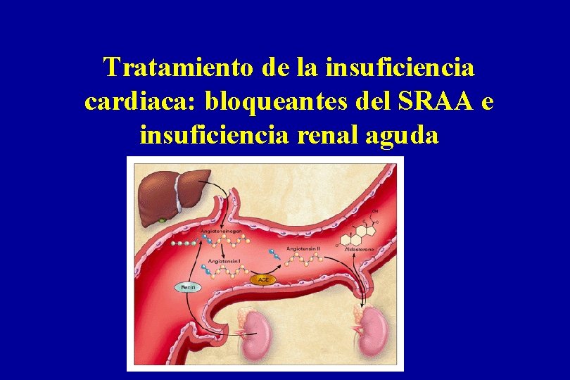 Tratamiento de la insuficiencia cardiaca: bloqueantes del SRAA e insuficiencia renal aguda 