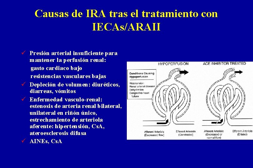 Causas de IRA tras el tratamiento con IECAs/ARAII ü Presión arterial insuficiente para mantener