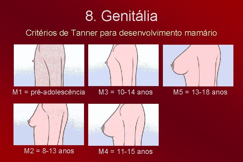 8. Genitália Critérios de Tanner para desenvolvimento mamário M 1 = pré-adolescência M 3