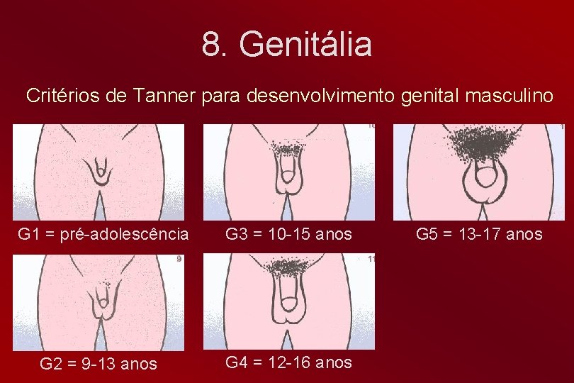 8. Genitália Critérios de Tanner para desenvolvimento genital masculino G 1 = pré-adolescência G