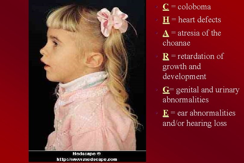  • C = coloboma • H = heart defects • A = atresia