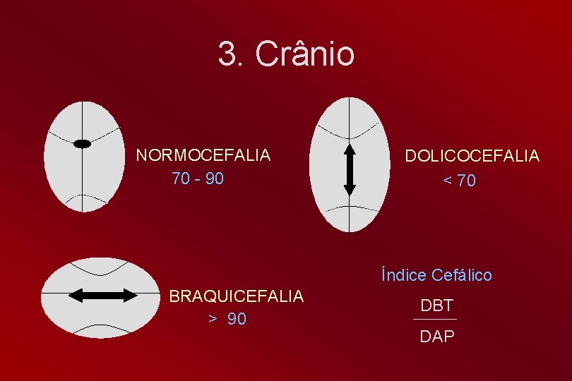 3. Crânio NORMOCEFALIA 70 - 90 DOLICOCEFALIA < 70 Índice Cefálico BRAQUICEFALIA > 90