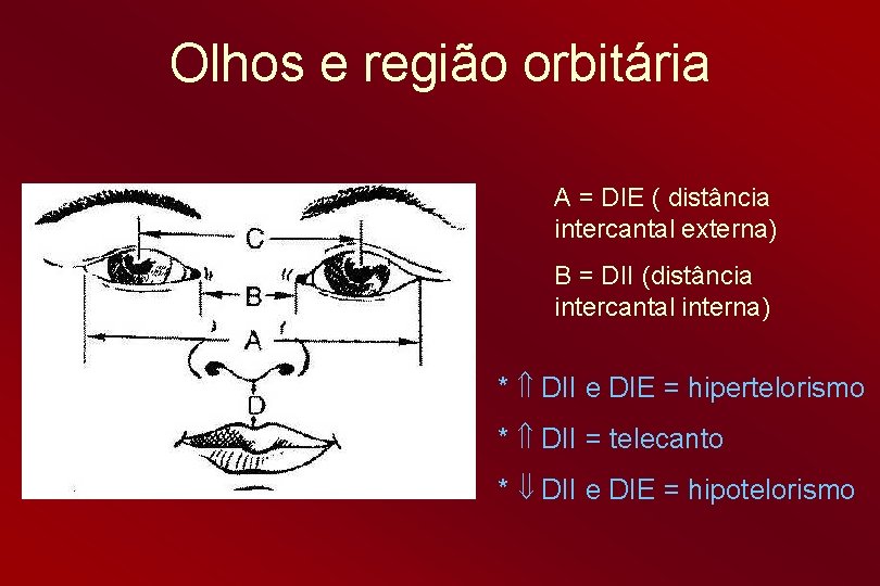 Olhos e região orbitária A = DIE ( distância intercantal externa) B = DII