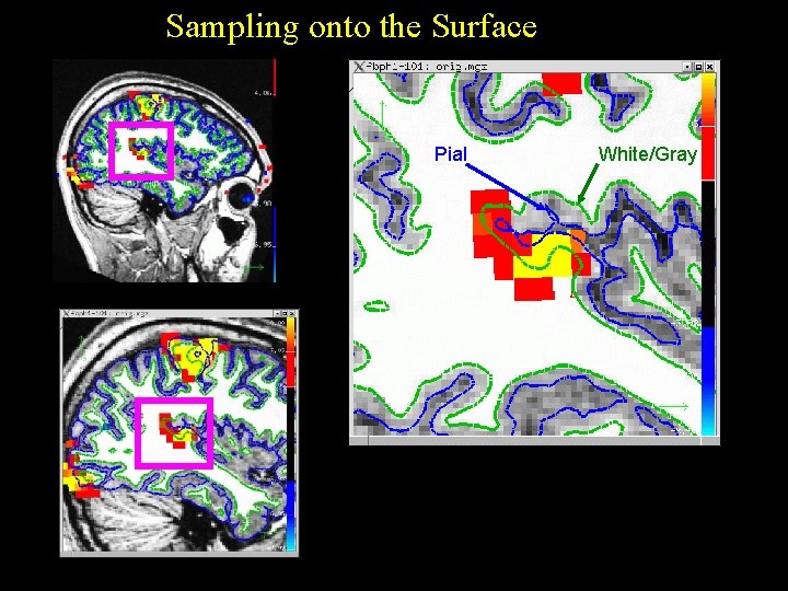 Sampling onto the Surface Pial White/Gray 