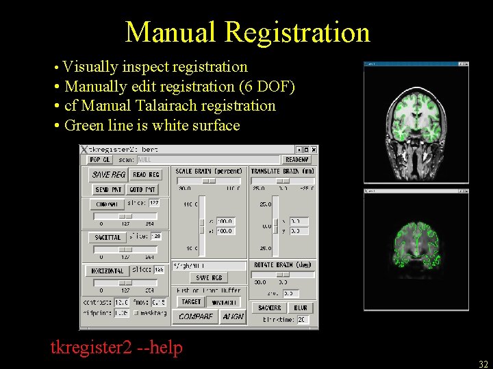 Manual Registration • Visually inspect registration • Manually edit registration (6 DOF) • cf