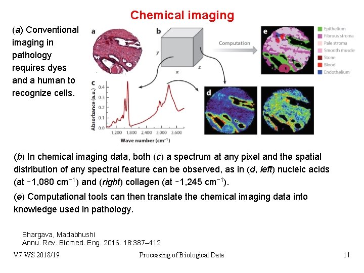 Chemical imaging (a) Conventional imaging in pathology requires dyes and a human to recognize