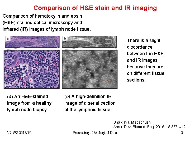 Comparison of H&E stain and IR imaging Comparison of hematoxylin and eosin (H&E)-stained optical