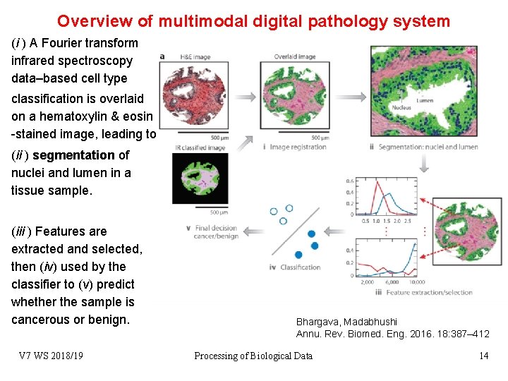 Overview of multimodal digital pathology system (i ) A Fourier transform infrared spectroscopy data–based