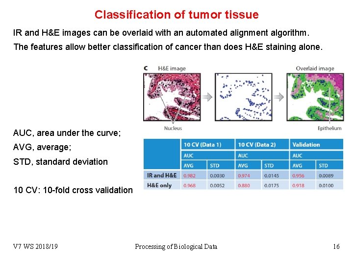 Classification of tumor tissue IR and H&E images can be overlaid with an automated