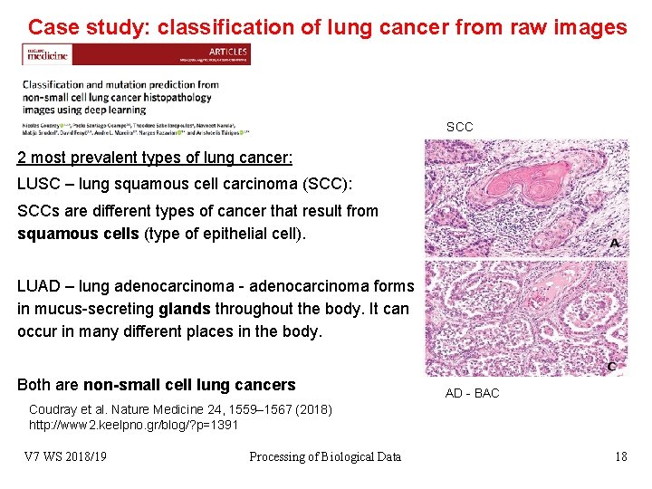 Case study: classification of lung cancer from raw images SCC 2 most prevalent types