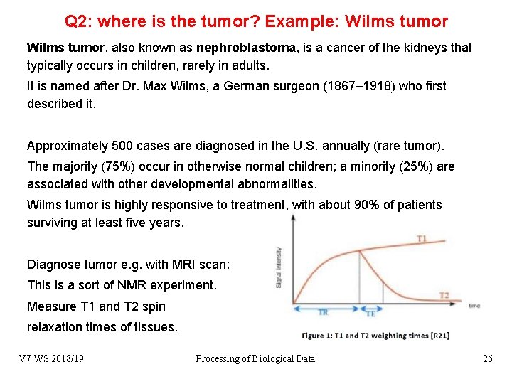 Q 2: where is the tumor? Example: Wilms tumor, also known as nephroblastoma, is