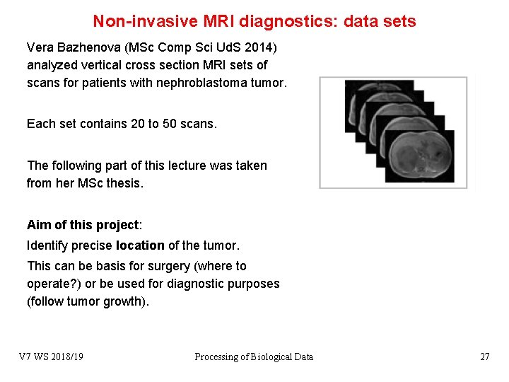 Non-invasive MRI diagnostics: data sets Vera Bazhenova (MSc Comp Sci Ud. S 2014) analyzed