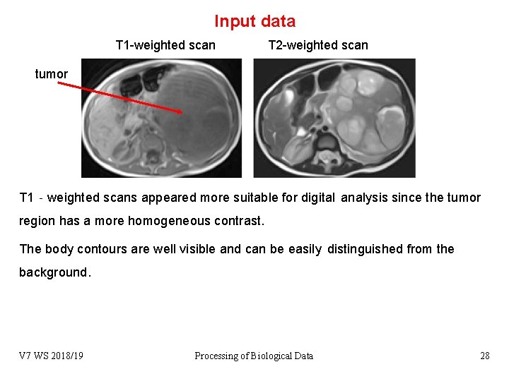 Input data T 1 -weighted scan T 2 -weighted scan tumor T 1‐weighted scans