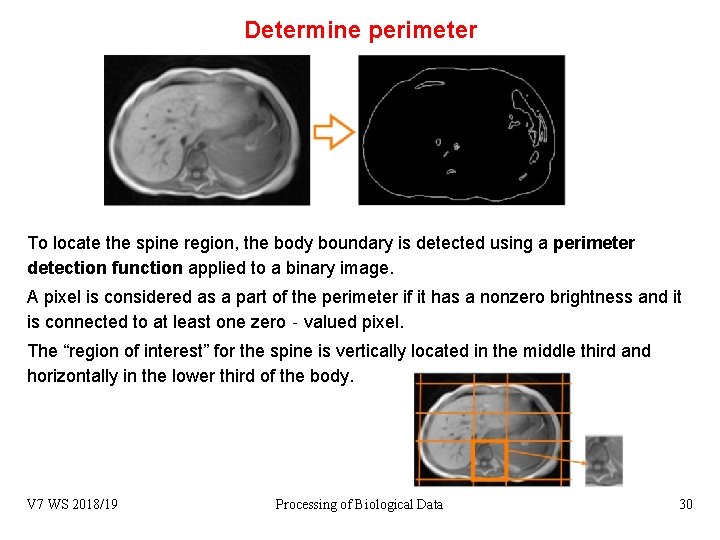 Determine perimeter To locate the spine region, the body boundary is detected using a