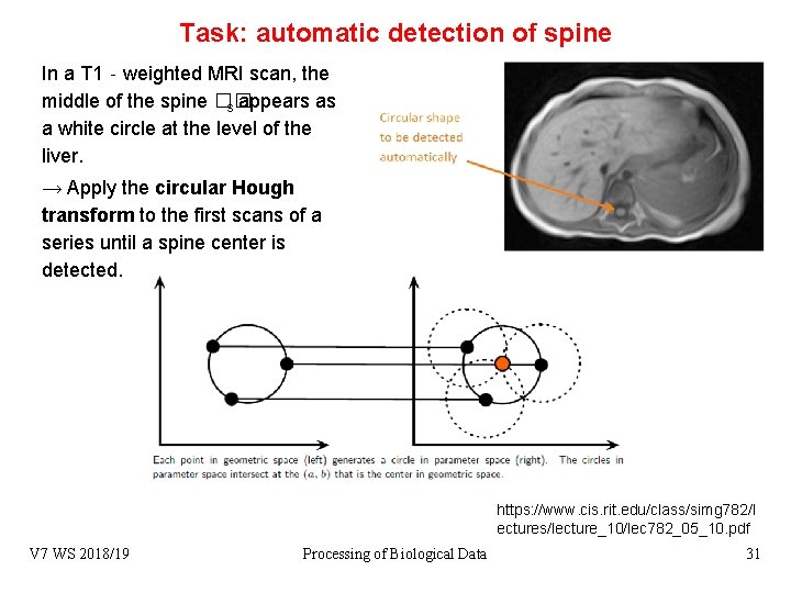 Task: automatic detection of spine In a T 1‐weighted MRI scan, the middle of