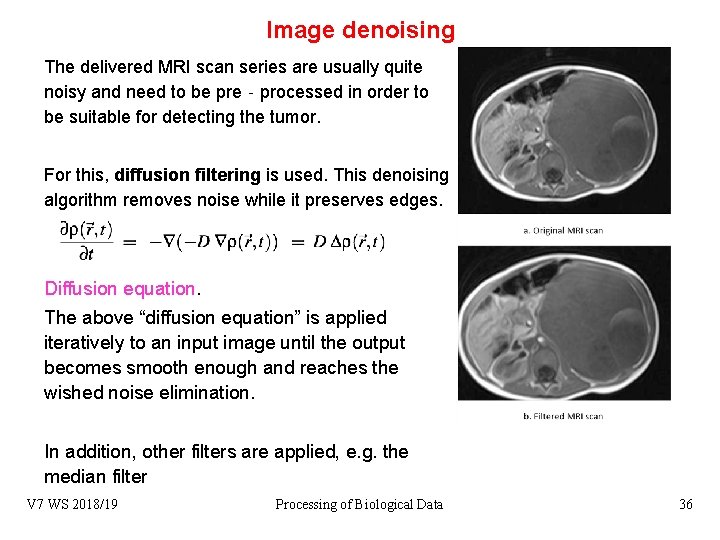Image denoising The delivered MRI scan series are usually quite noisy and need to
